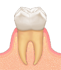 歯周病の進行度（正常）